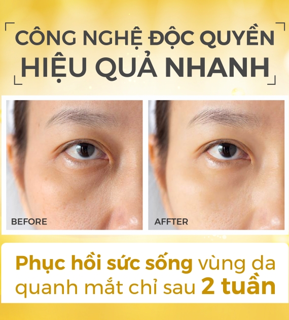 Kem dưỡng mắt RECIPE mờ thâm dưỡng sáng, giảm nếp nhăn, kem mắt Lifting Recipe Dark Cover Eye Cream 30ml