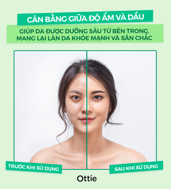 Tinh Chất Dưỡng Trà Xanh Ottie Green Tea Essence 40ml