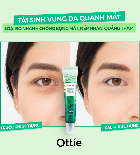 Kem Dưỡng Mắt Trà Xanh Ottie Green Tea Eye Cream 30ml